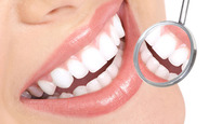 Guida alla scelta del giusto impianto dentale